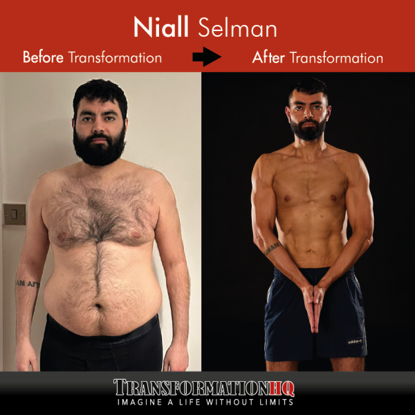 Before & After Niall Selman